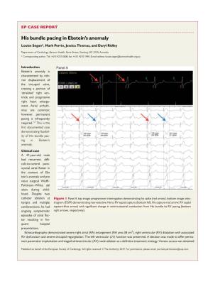 His Bundle Pacing in Ebstein's Anomaly