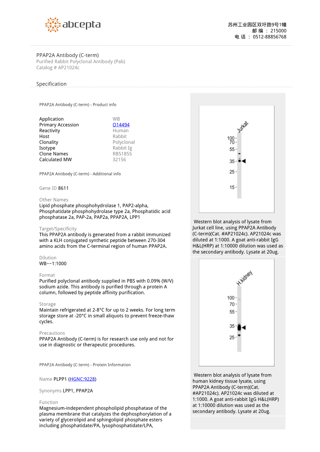 PPAP2A Antibody (C-Term) Purified Rabbit Polyclonal Antibody (Pab) Catalog # Ap21024c