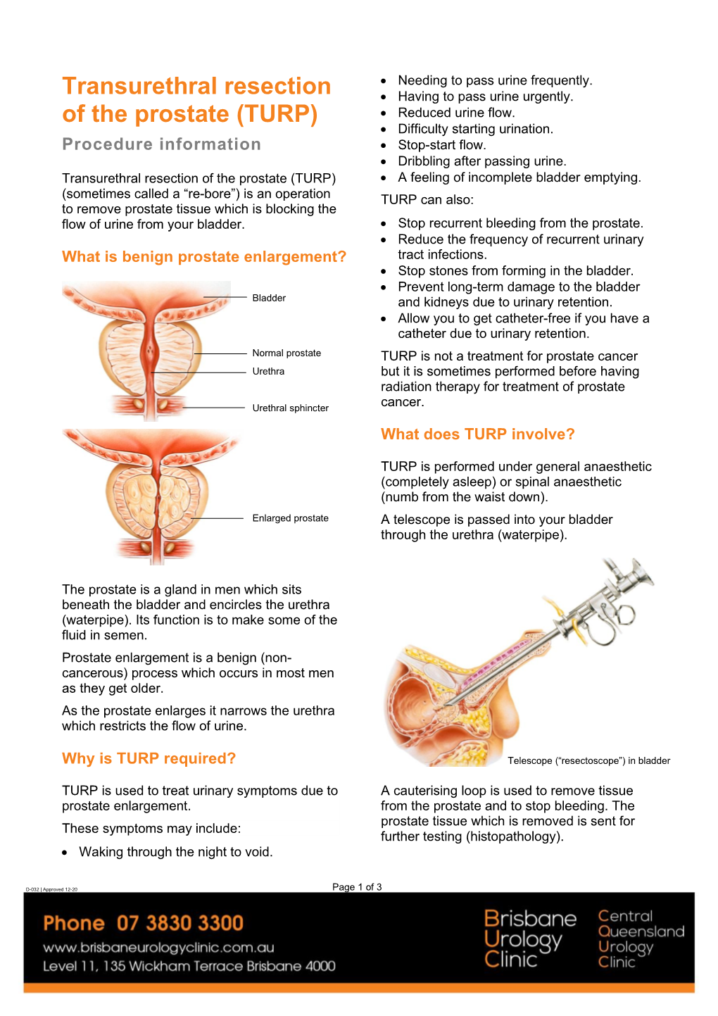 Transurethral Resection of the Prostate (TURP) • a Feeling of Incomplete Bladder Emptying