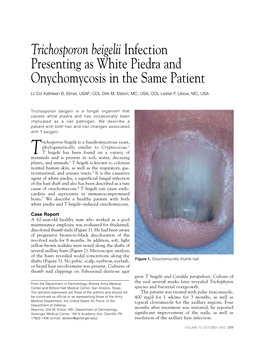 Trichosporon Beigelii Infection Presenting As White Piedra and Onychomycosis in the Same Patient