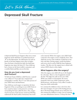 Depressed Skull Fracture (Let's Talk About