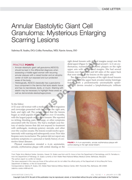 Annular Elastolytic Giant Cell Granuloma: Mysterious Enlarging Scarring Lesions
