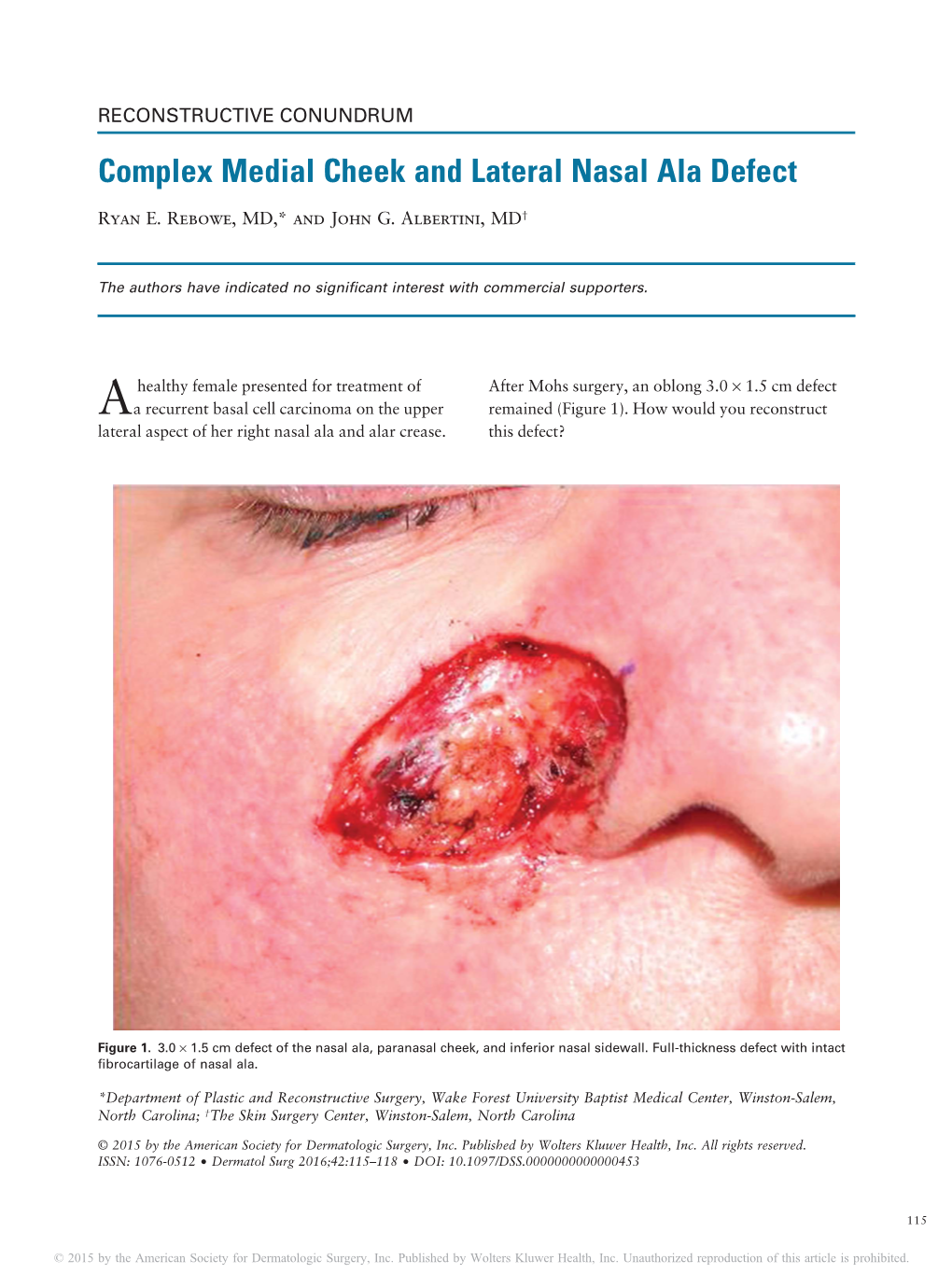 Complex Medial Cheek and Lateral Nasal Ala Defect