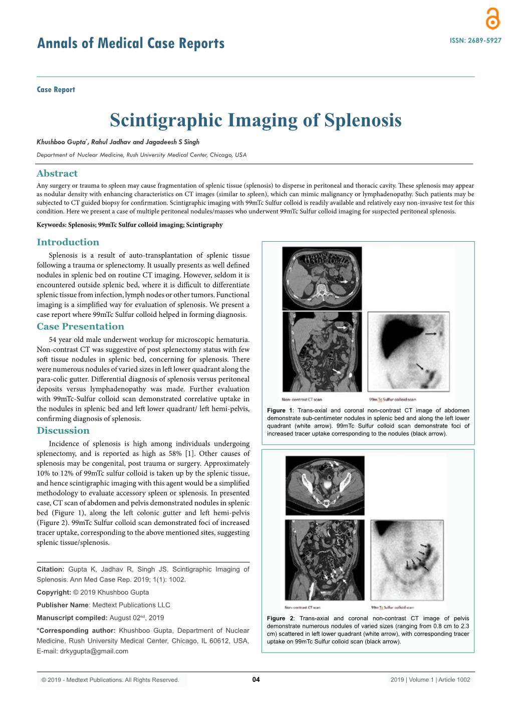 Scintigraphic Imaging of Splenosis Khushboo Gupta*, Rahul Jadhav and Jagadeesh S Singh Department of Nuclear Medicine, Rush University Medical Center, Chicago, USA