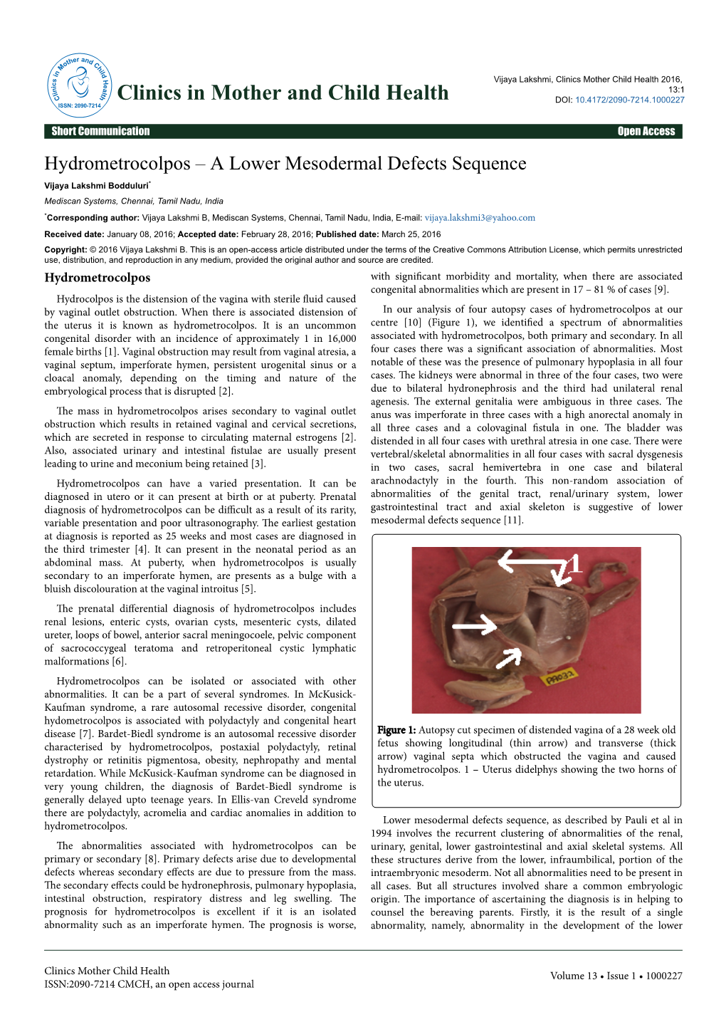 Hydrometrocolpos – a Lower Mesodermal Defects Sequence