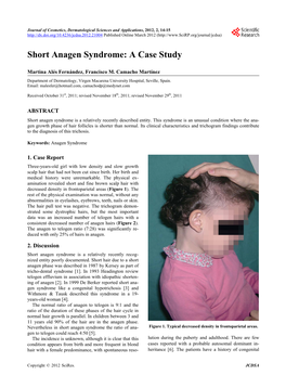 Short Anagen Syndrome: a Case Study
