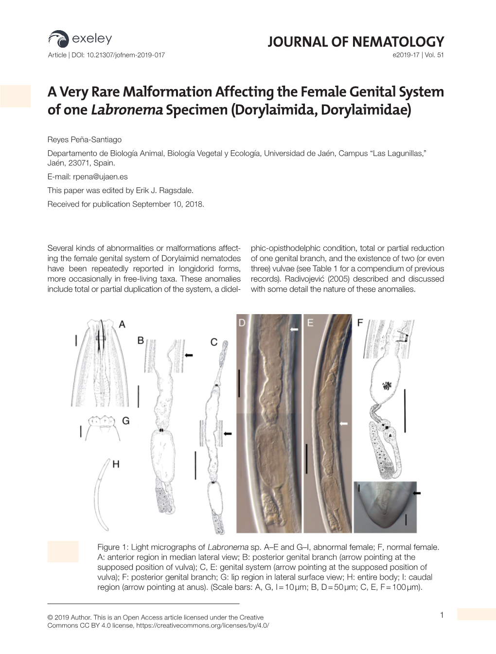 A Very Rare Malformation Affecting the Female Genital System of One Labronema Specimen (Dorylaimida, Dorylaimidae)