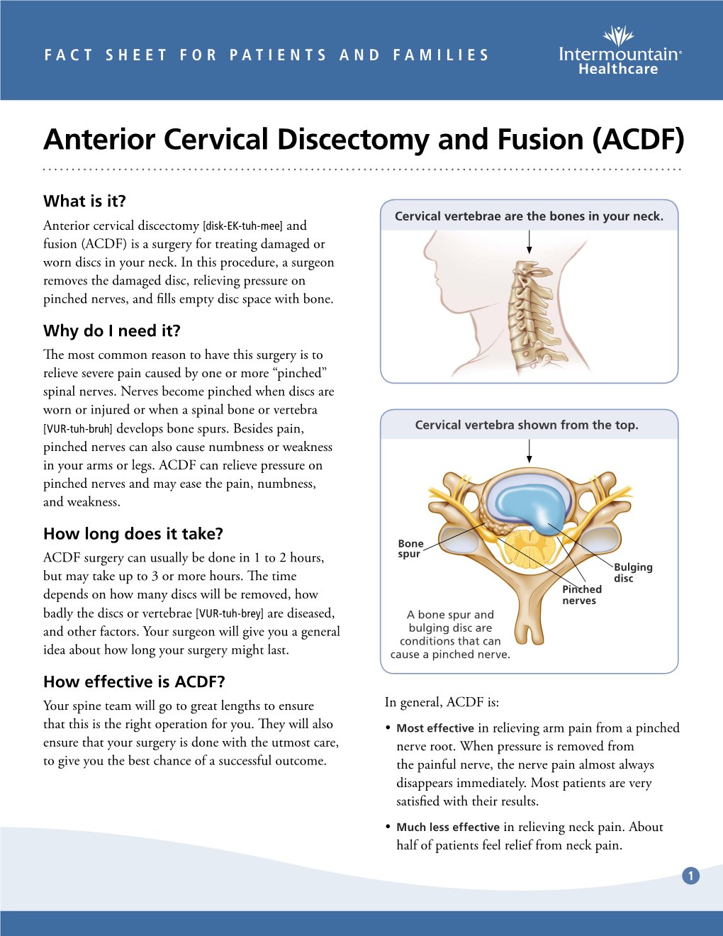 Anterior Cervical Discectomy and Fusion (ACDF)