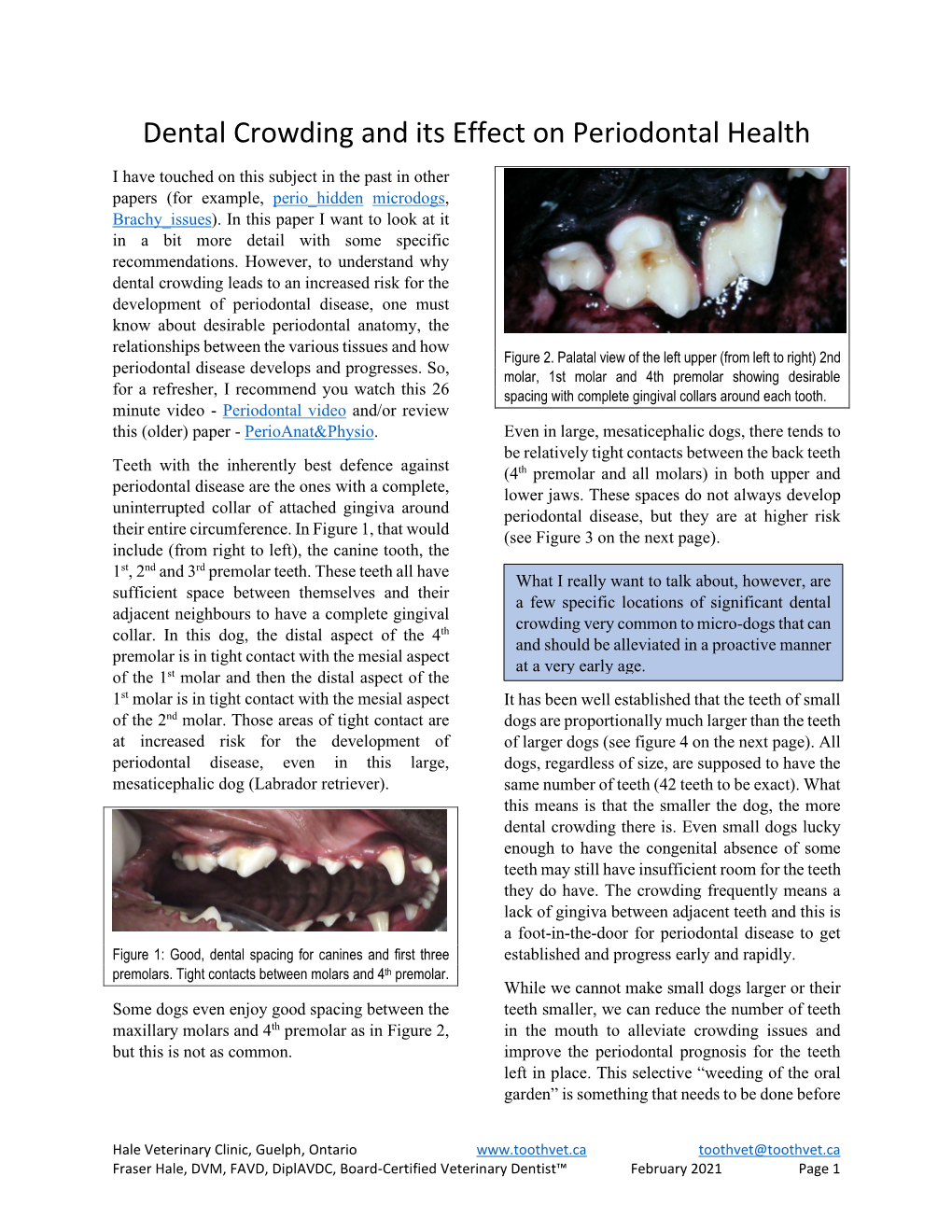 Dental Crowding and Its Effect on Periodontal Health