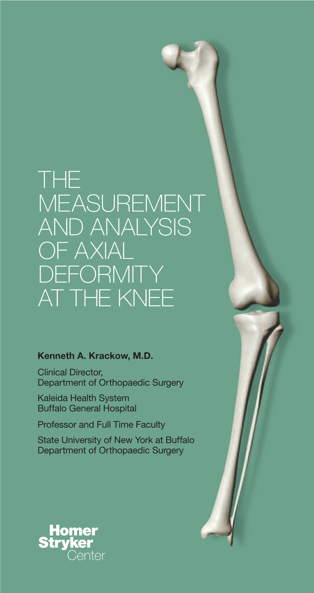 How to Measure Knee Alignment