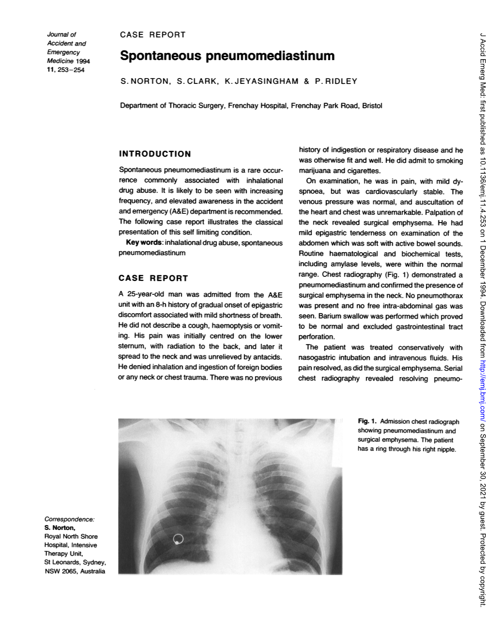 Spontaneous Pneumomediastinum 11, 253-254 S