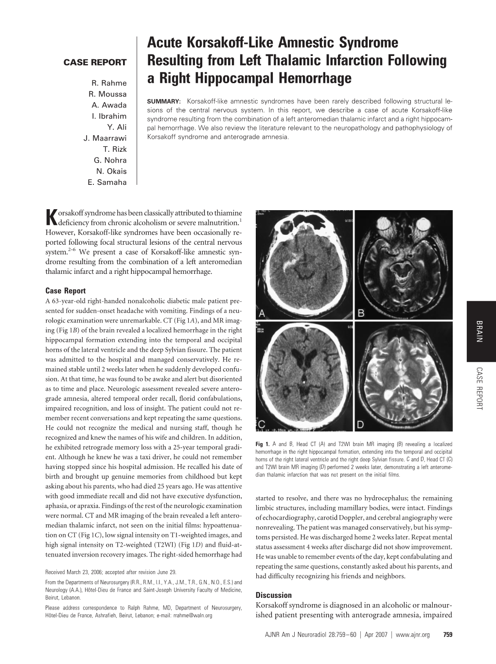 Acute Korsakoff-Like Amnestic Syndrome Resulting from Left