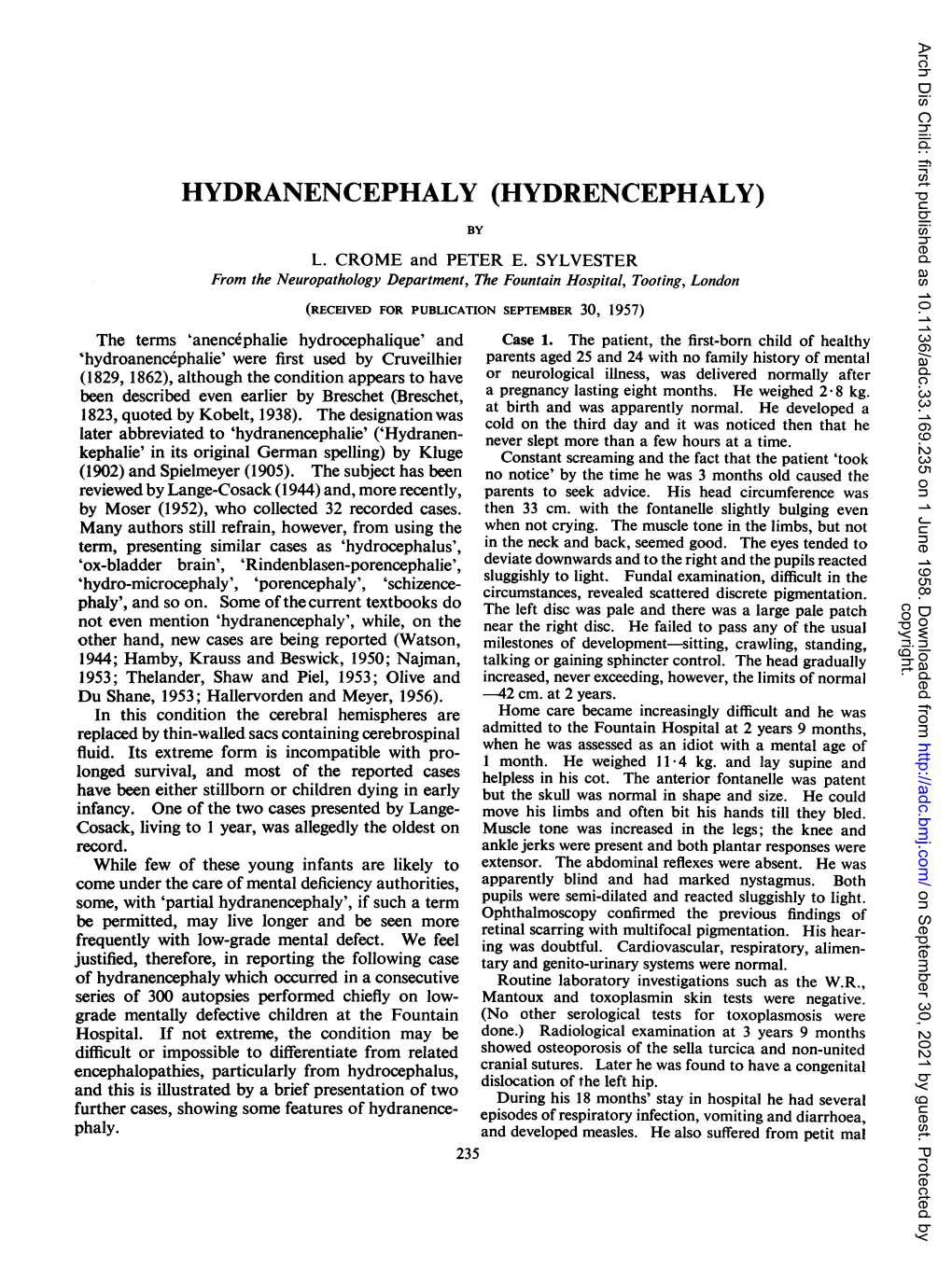 Hydranencephaly (Hydrencephaly)