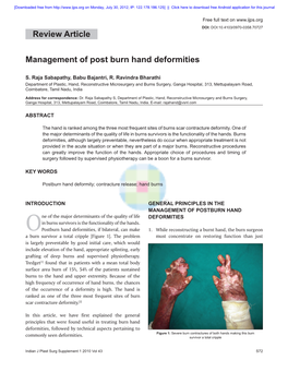 Management of Post Burn Hand Deformities Review Article