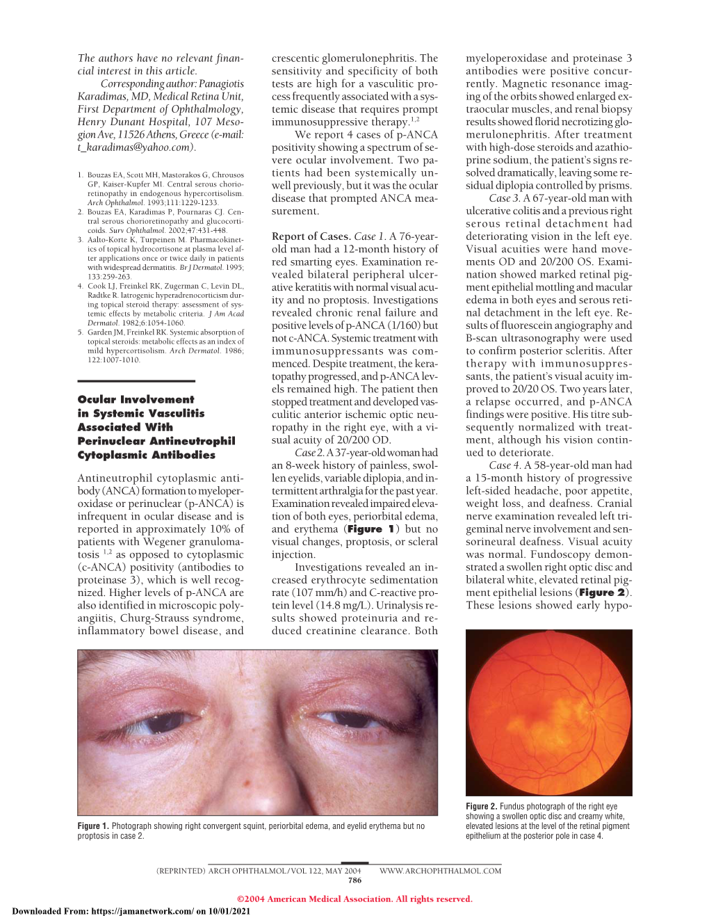 Ocular Involvement in Systemic Vasculitis Associated With