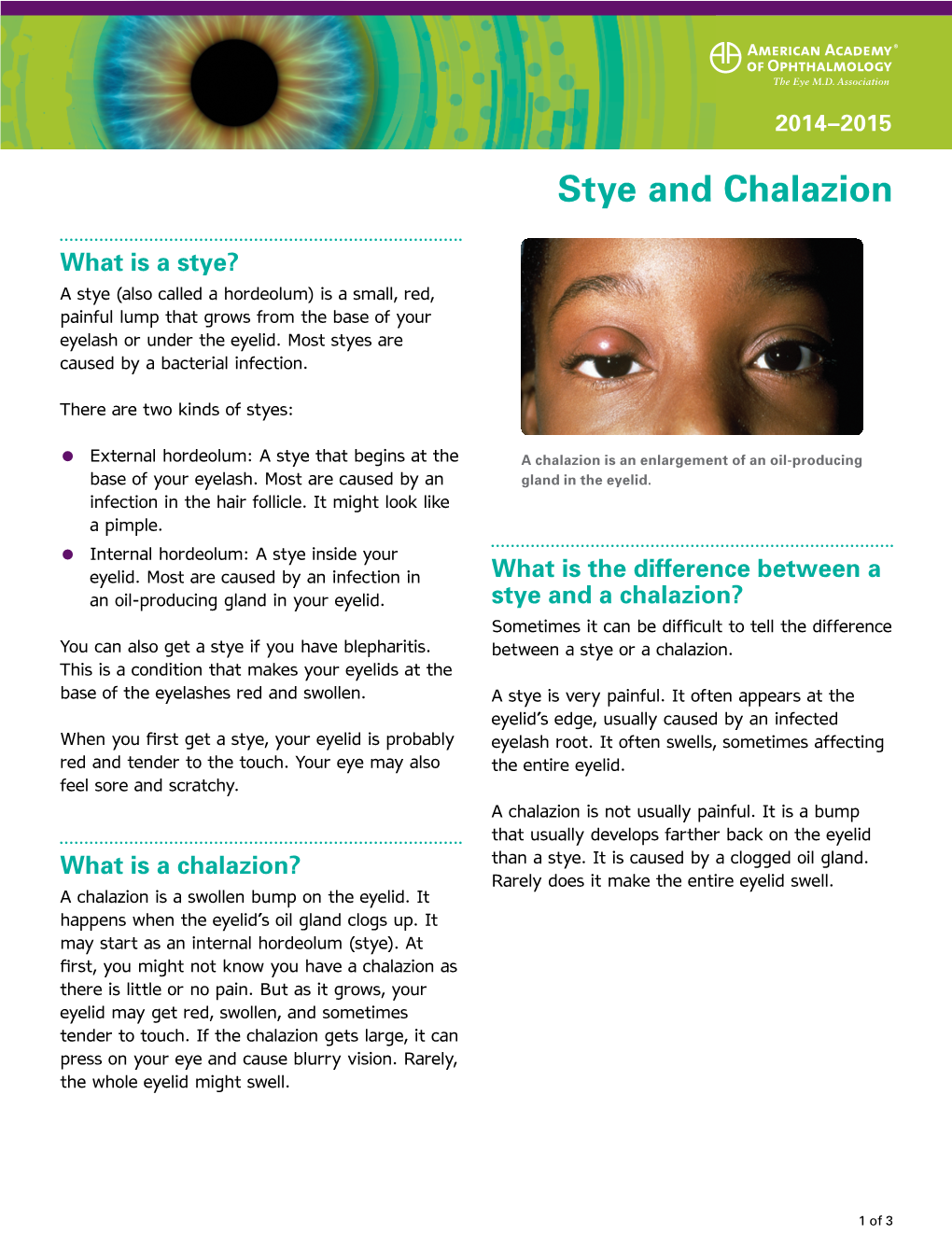 Stye and Chalazion