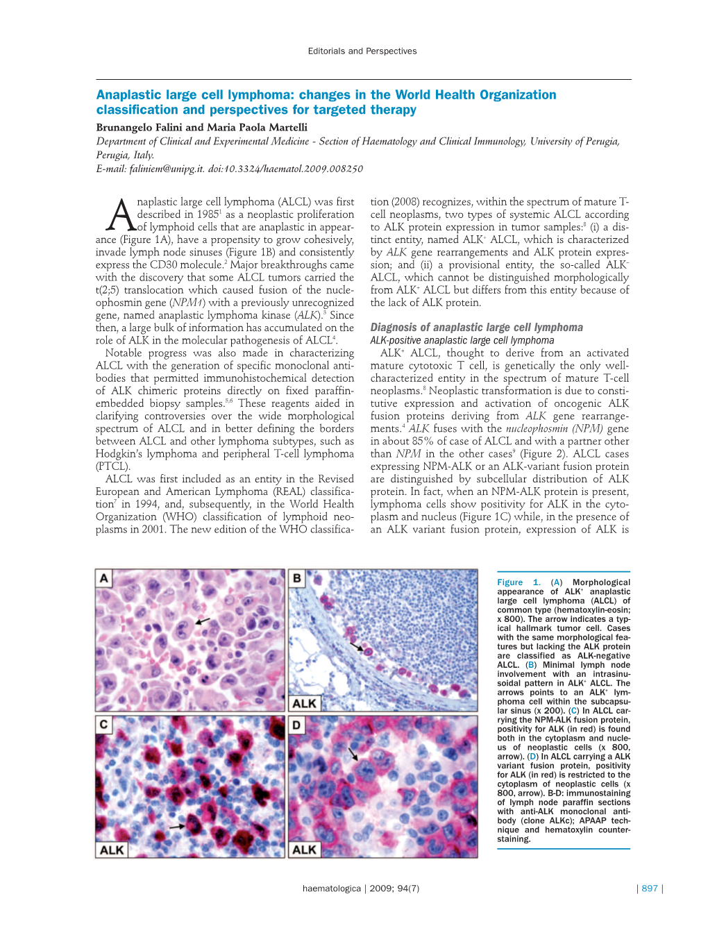 Anaplastic Large Cell Lymphoma