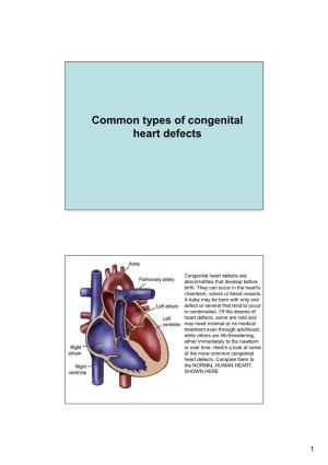 Common Types of Congenital Heart Defects