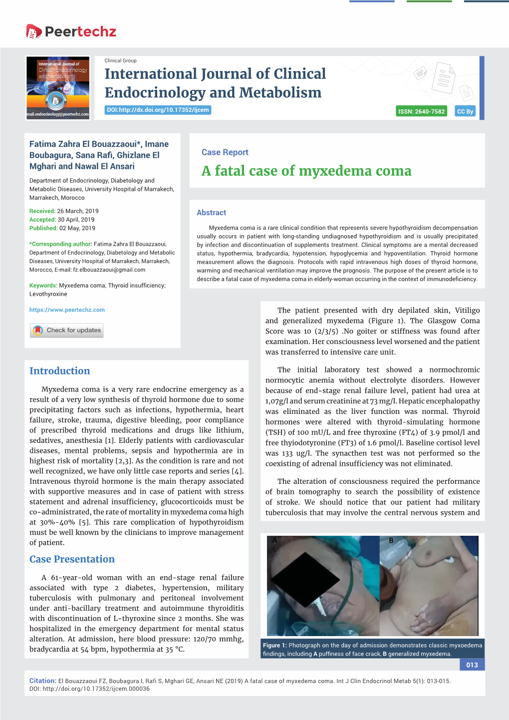 A Fatal Case of Myxedema Coma Department of Endocrinology, Diabetology and Metabolic Diseases, University Hospital of Marrakech, Marrakech, Morocco