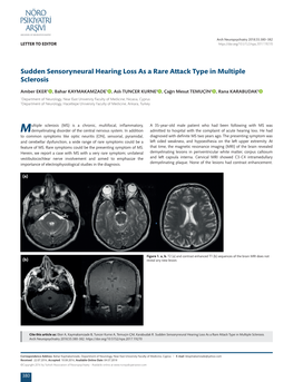 Sudden Sensoryneural Hearing Loss As a Rare Attack Type in Multiple Sclerosis