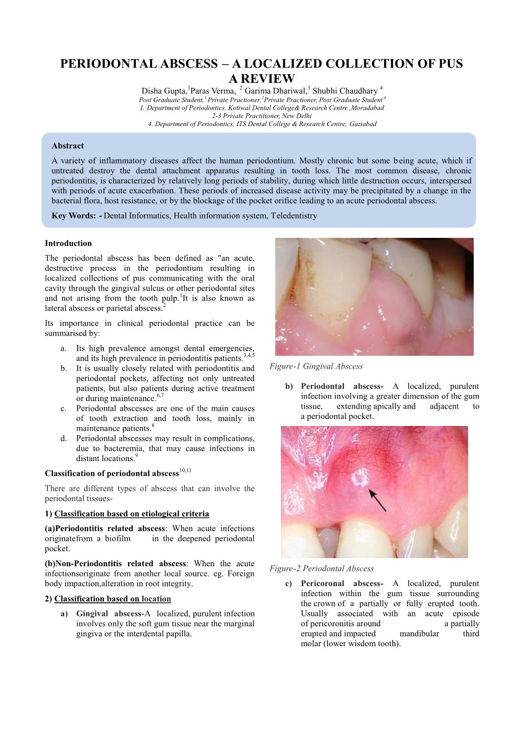 Periodontal Abscess – a Localized Collection of Pus a Review