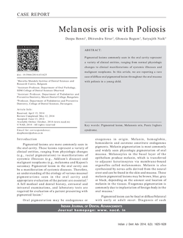 Melanosis Oris with Poliosis