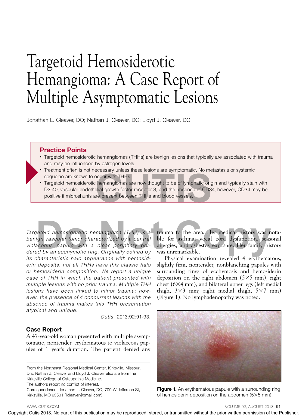 Targetoid Hemosiderotic Hemangioma: a Case Report of Multiple Asymptomatic Lesions