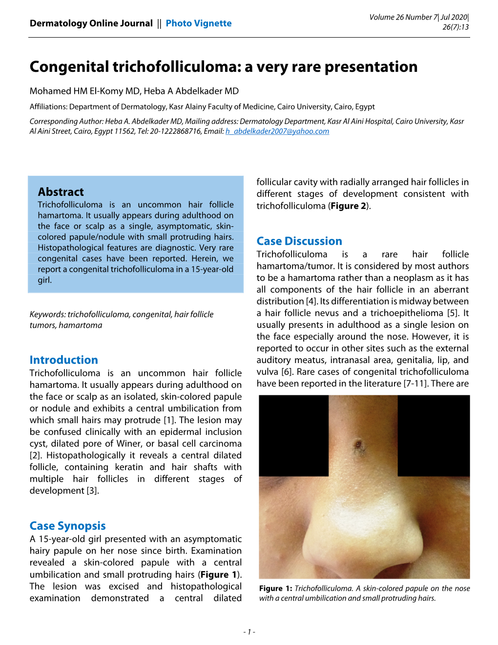 Congenital Trichofolliculoma: a Very Rare Presentation