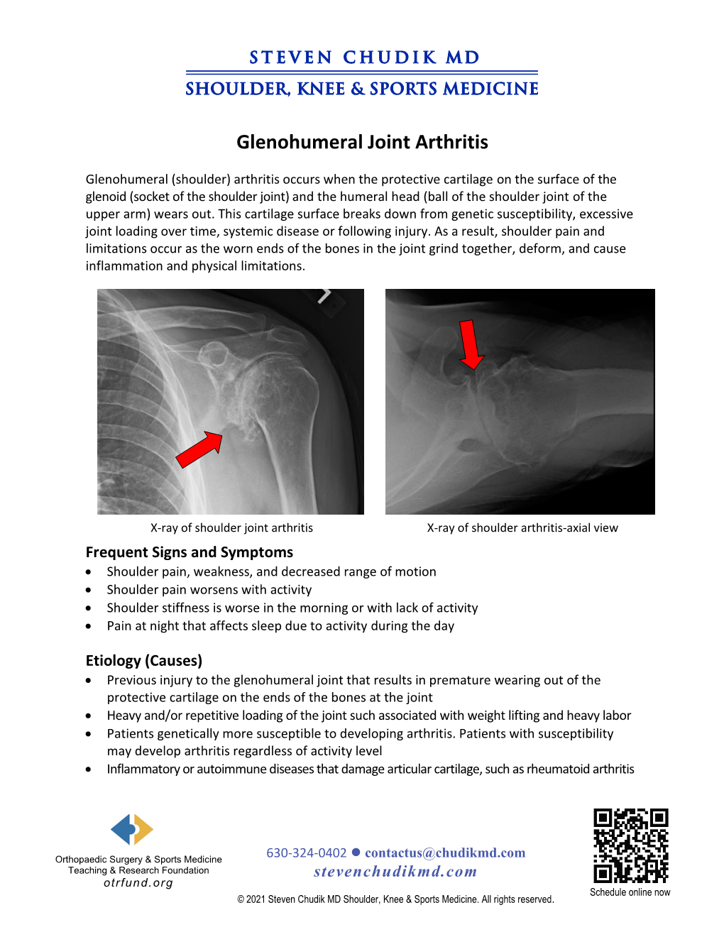 Glenohumeral Joint Arthritis