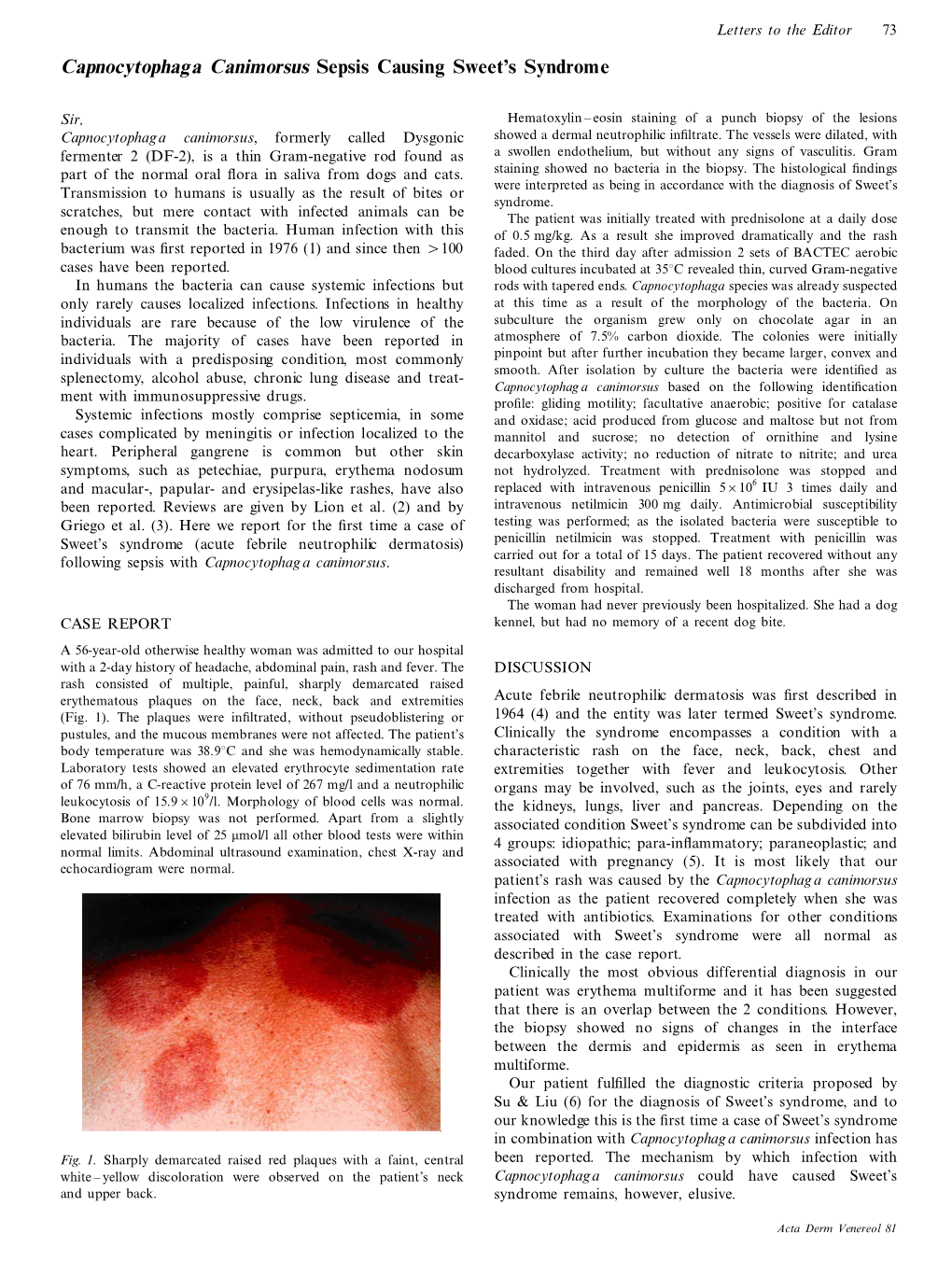 Capnocytophaga Canimorsus Sepsis Causing Sweet's Syndrome