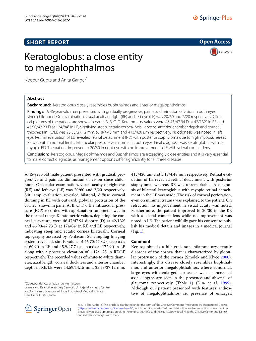 Keratoglobus: a Close Entity to Megalophthalmos Noopur Gupta and Anita Ganger*