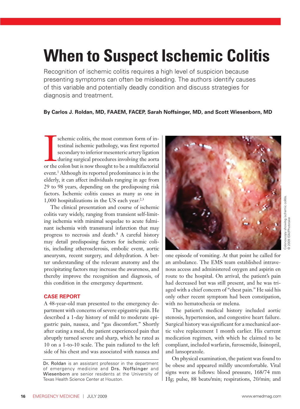 When to Suspect Ischemic Colitis Recognition of Ischemic Colitis Requires a High Level of Suspicion Because Presenting Symptoms Can Often Be Misleading