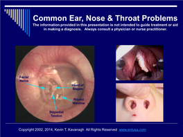Common Ear, Nose & Throat Problems
