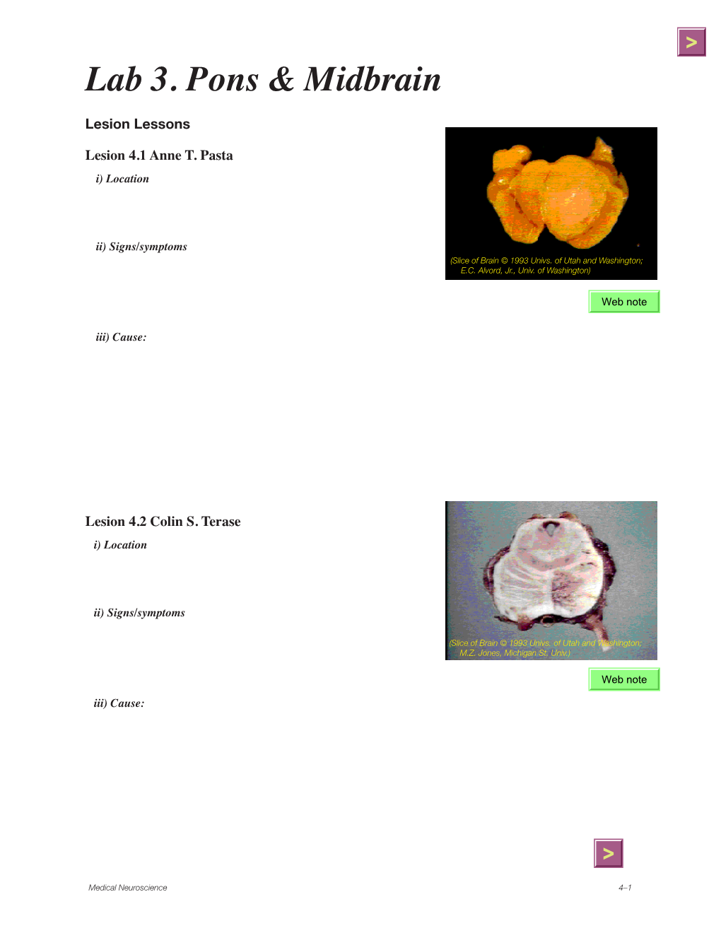 Lab 3. Pons & Midbrain