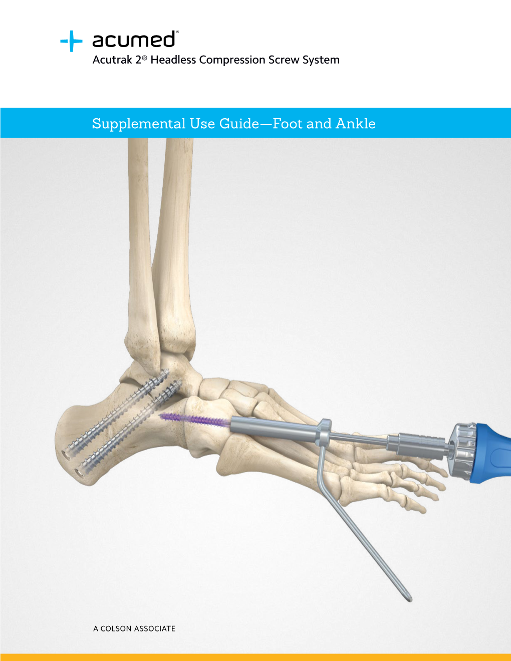 Acutrak 2 Supplemental Use Guide