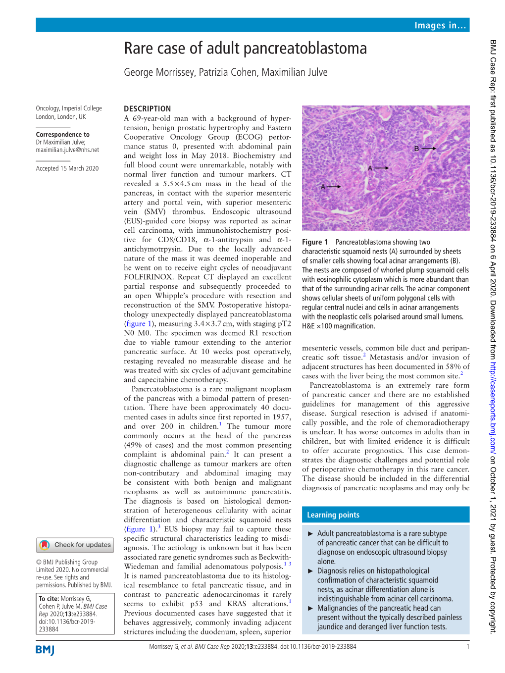 Rare Case of Adult Pancreatoblastoma George Morrissey, Patrizia Cohen, Maximilian Julve