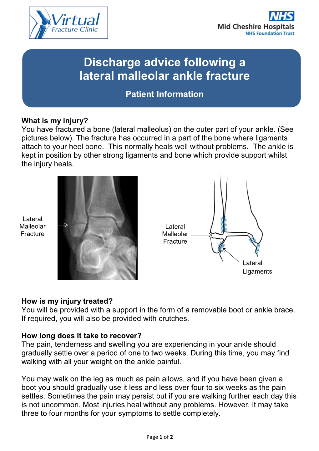 Discharge Advice Following a Lateral Malleolar Ankle Fracture