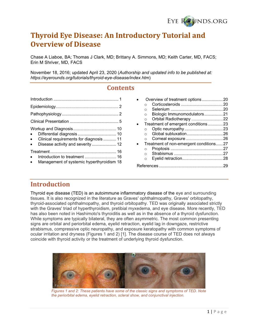 Thyroid Eye Disease: an Introductory Tutorial and Overview of Disease