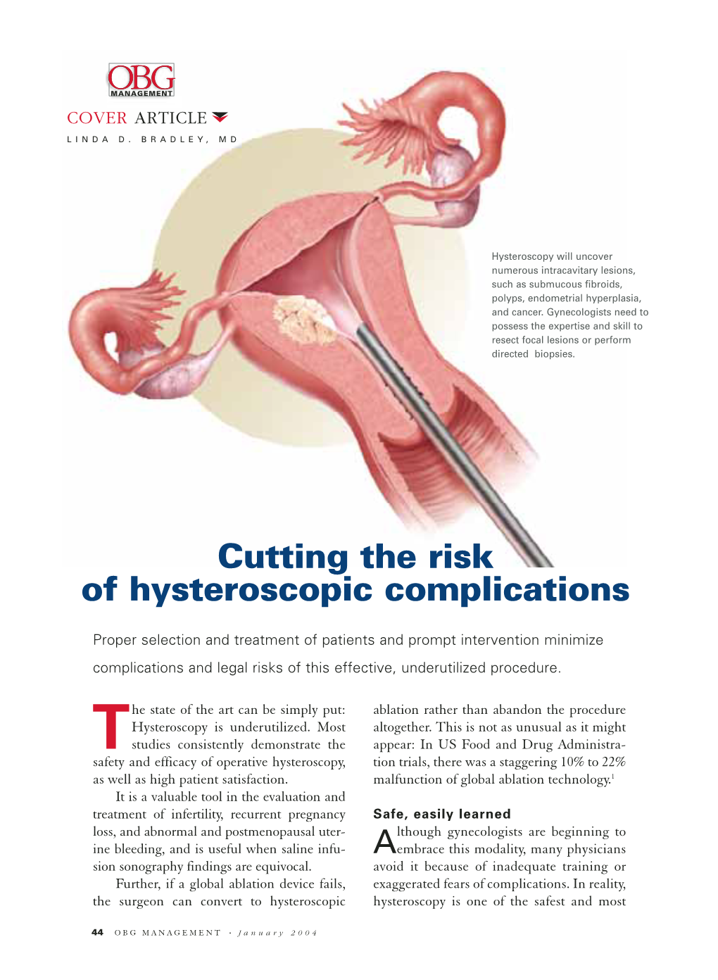 Cutting the Risk of Hysteroscopic Complications