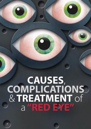 CAUSES, COMPLICATIONS &TREATMENT of A“RED EYE”
