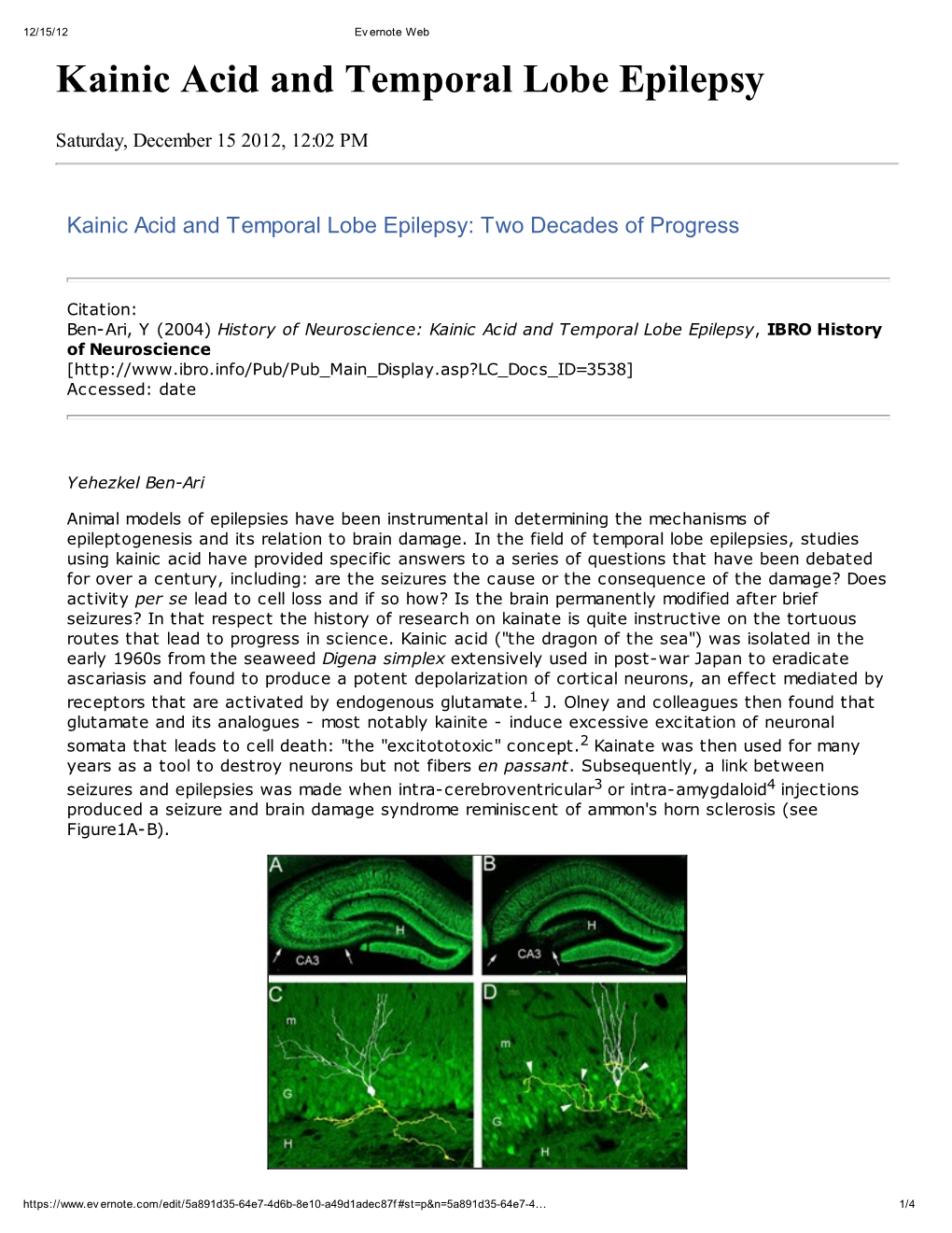 Kainic Acid and Temporal Lobe Epilepsy