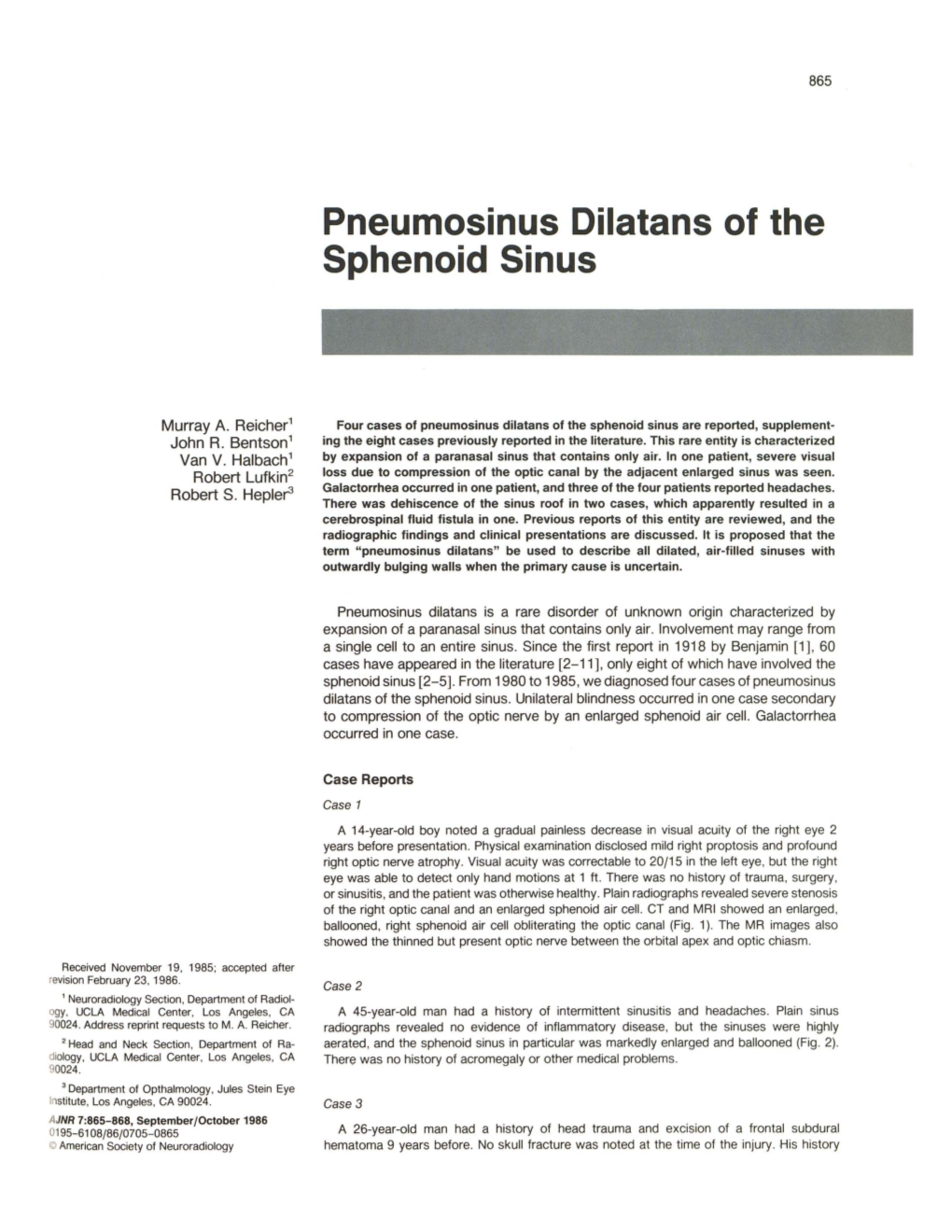 Pneumosinus Dilatans of the Sphenoid Sinus