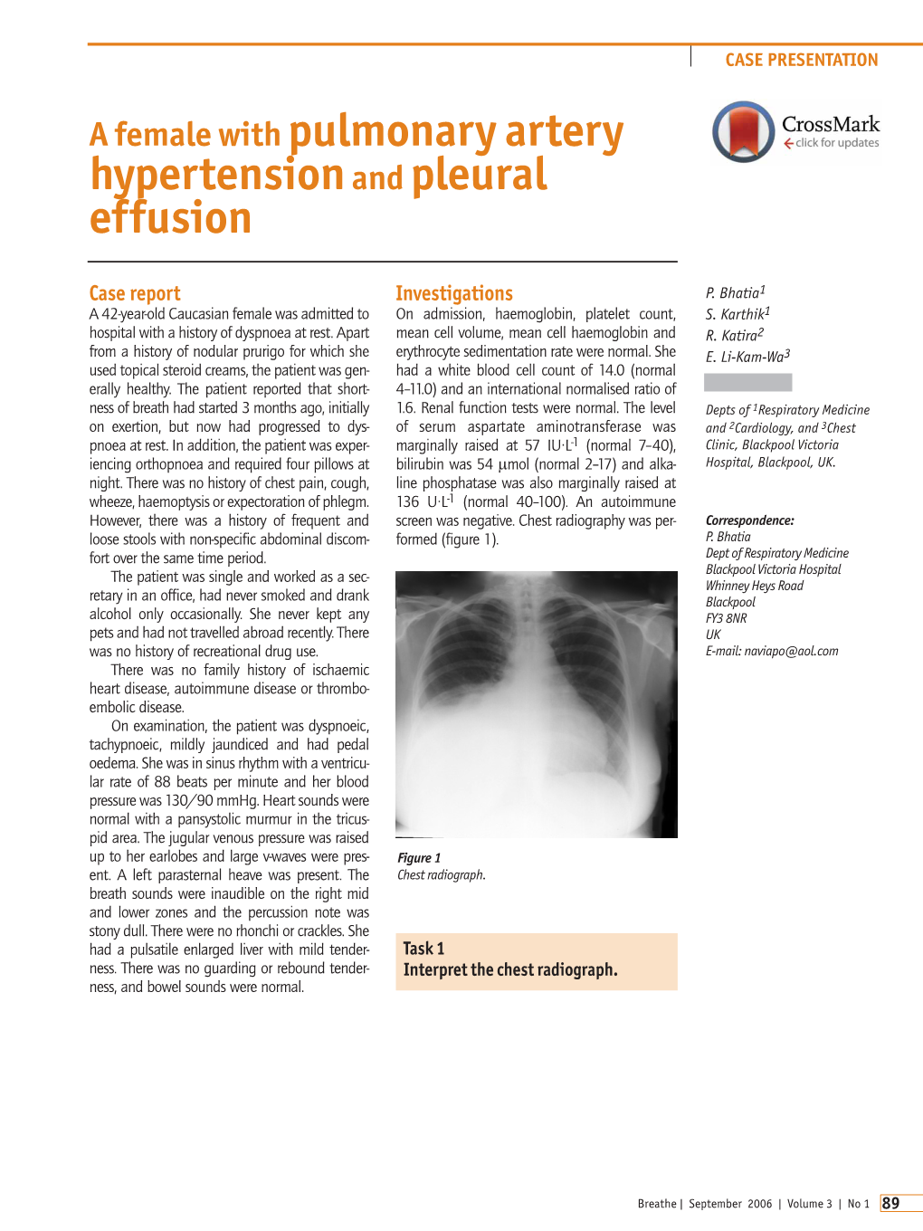 A Female with Pulmonary Artery Hypertension and Pleural Effusion