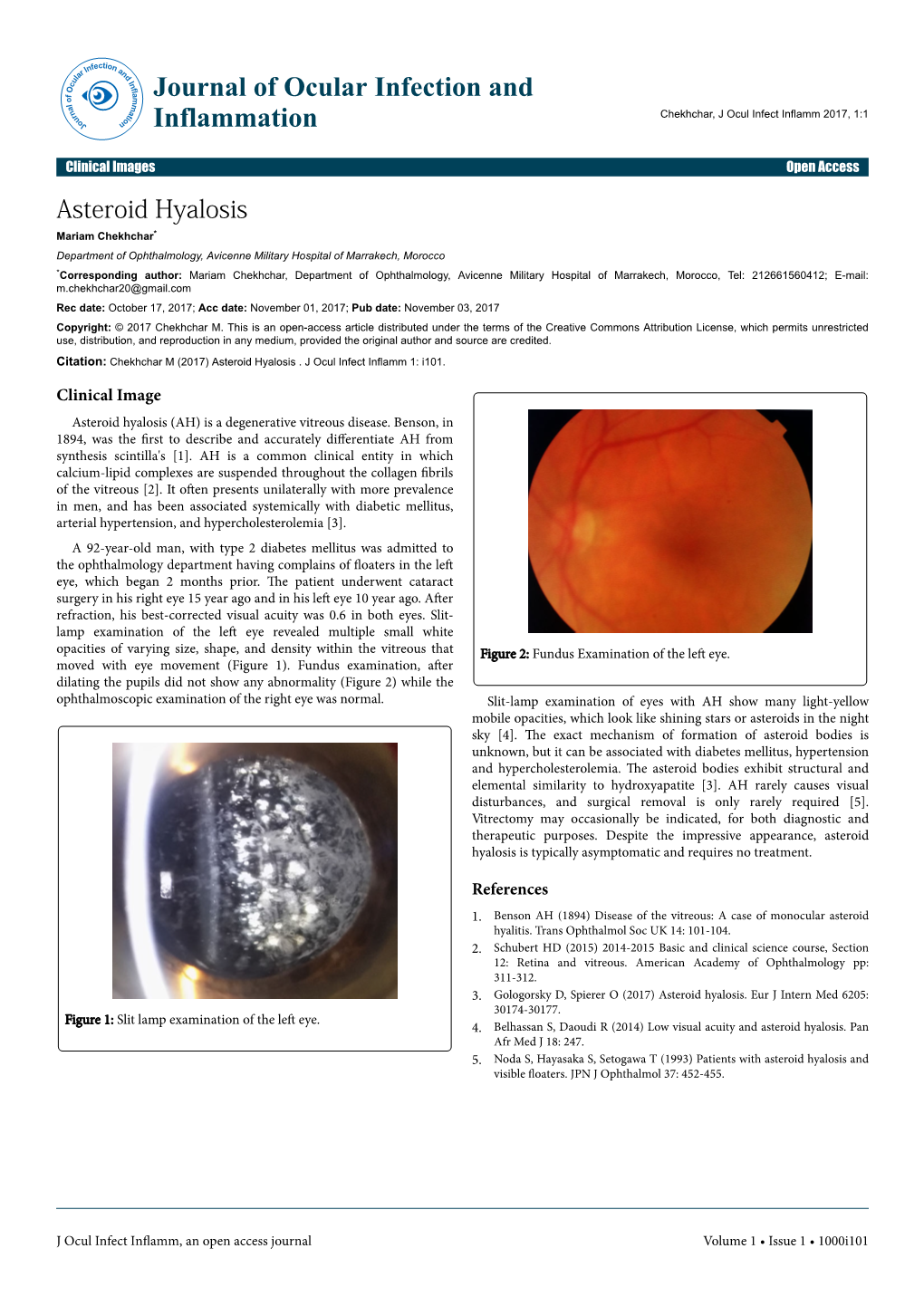 Asteroid Hyalosis