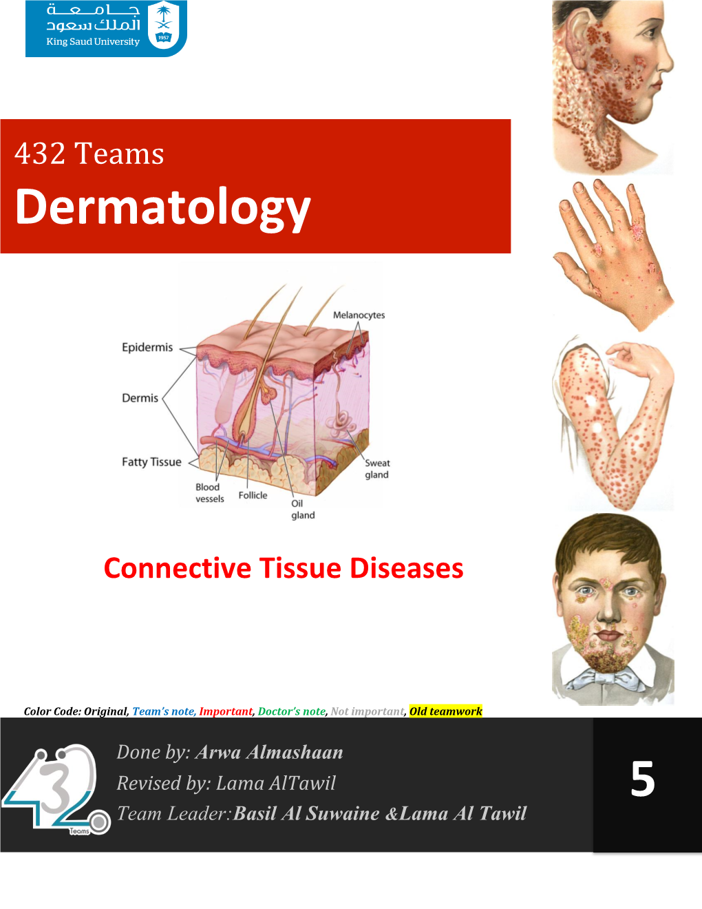 Lupus Erythematosus