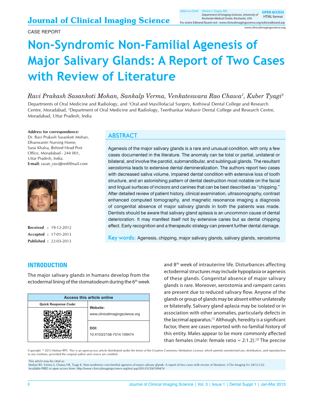 Non‑Syndromic Non‑Familial Agenesis of Major Salivary Glands: a Report of Two Cases with Review of Literature