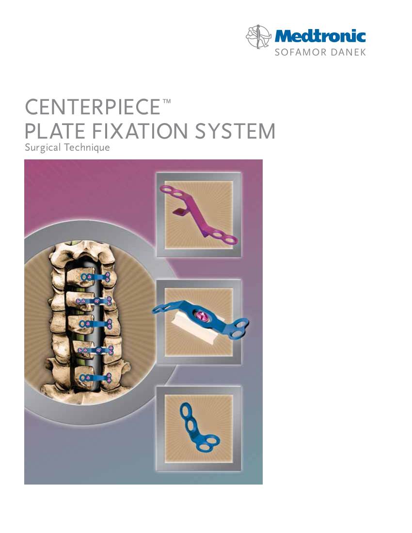 CENTERPIECE™ PLATE FIXATION SYSTEM Surgical Technique CENTERPIECE™ Surgical Technique Preface 1