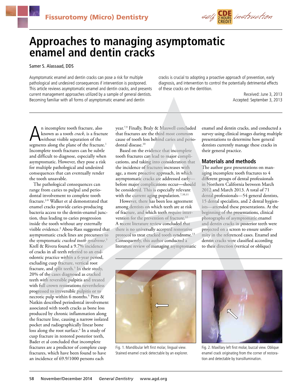 Approaches to Managing Asymptomatic Enamel and Dentin Cracks Samer S
