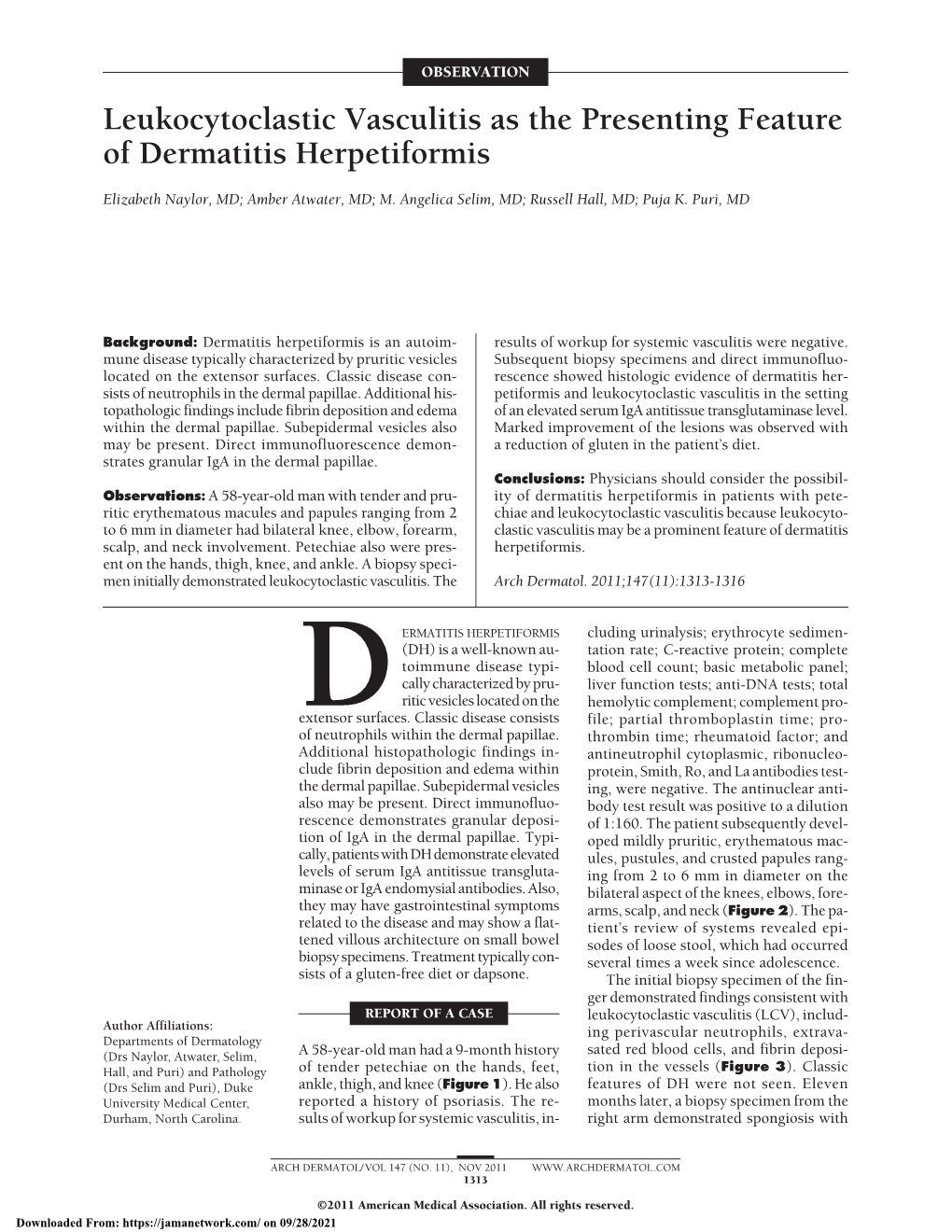 Leukocytoclastic Vasculitis As the Presenting Feature of Dermatitis Herpetiformis
