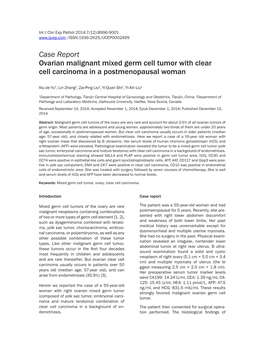 Case Report Ovarian Malignant Mixed Germ Cell Tumor with Clear Cell Carcinoma in a Postmenopausal Woman